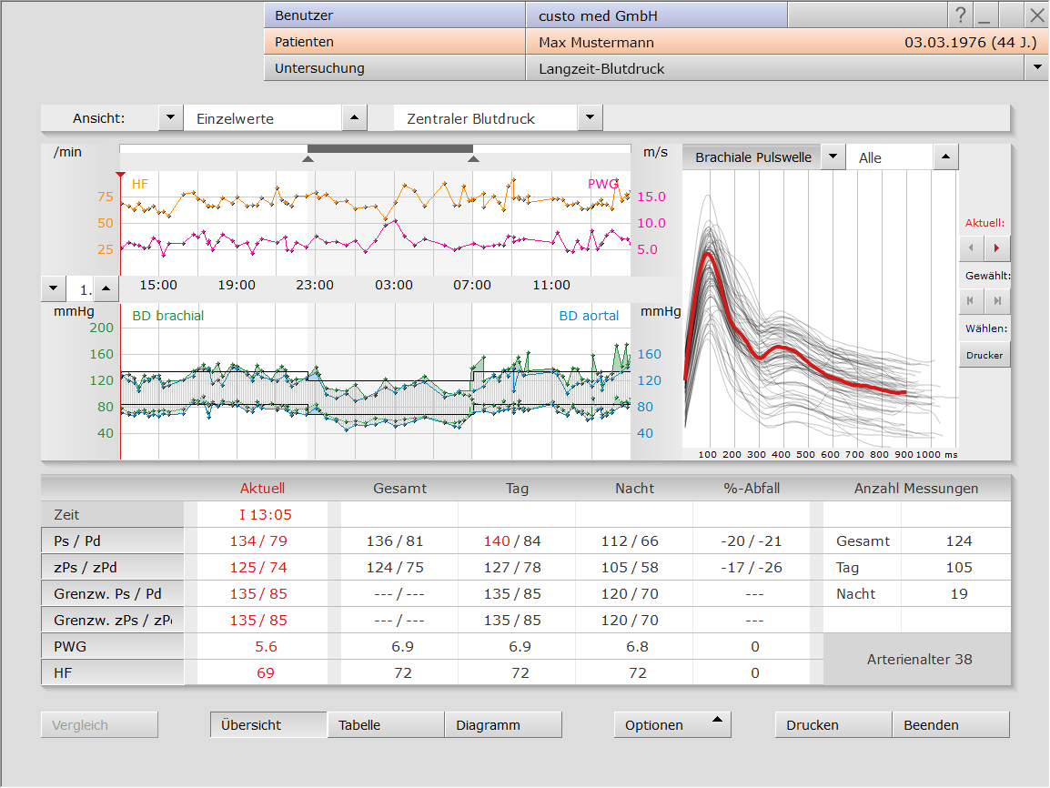 Langzeit-Blutdruck in der custo diagnostic